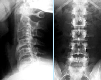 X-Ray Results